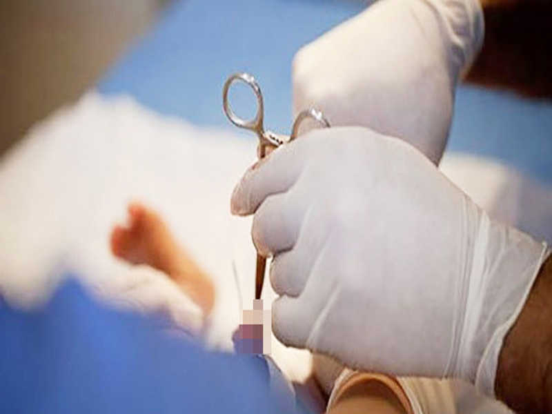 Phẫu thuật cắt bao quy đầu theo cách truyền thống lâu khỏi hơn