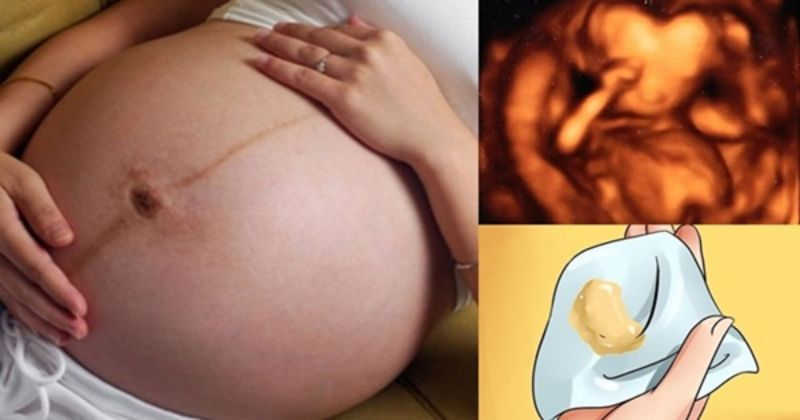 Những triệu chứng khi bị viêm âm đạo lúc mang thai