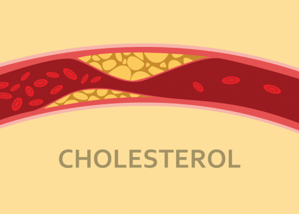 Giúp kiểm soát lượng Cholesterol trong cơ thể