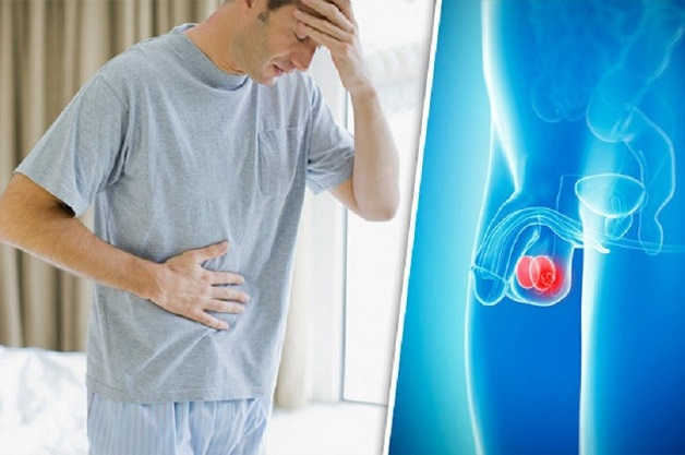 Những ảnh hưởng tiêu cực khi bị đau bìu tinh hoàn ở nam giới