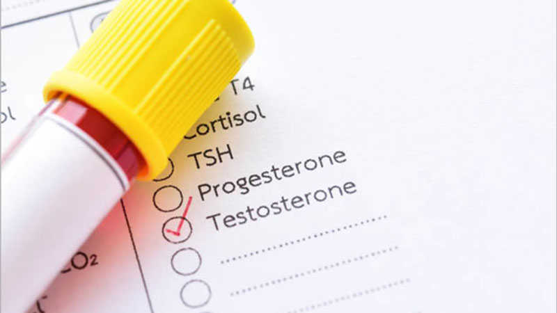 Chỉ số Testosterone trong nội tiết tố nữ