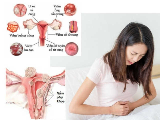 Mang thai 3 tháng đầu đau lưng có sao không - Do bệnh lý