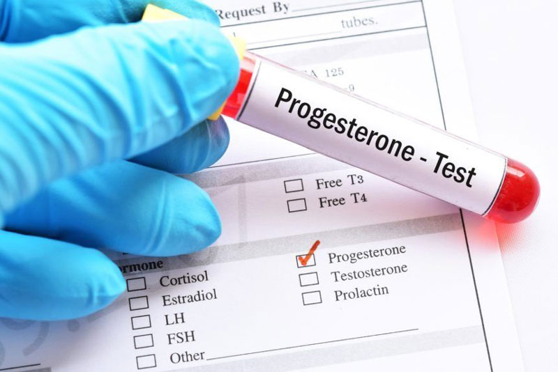 Xét nghiệm nội tiết tố nữ vào ngày nào? - Xét nghiệm Progesterone