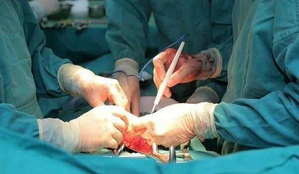 Phẫu thuật cắt bỏ u ác tính
