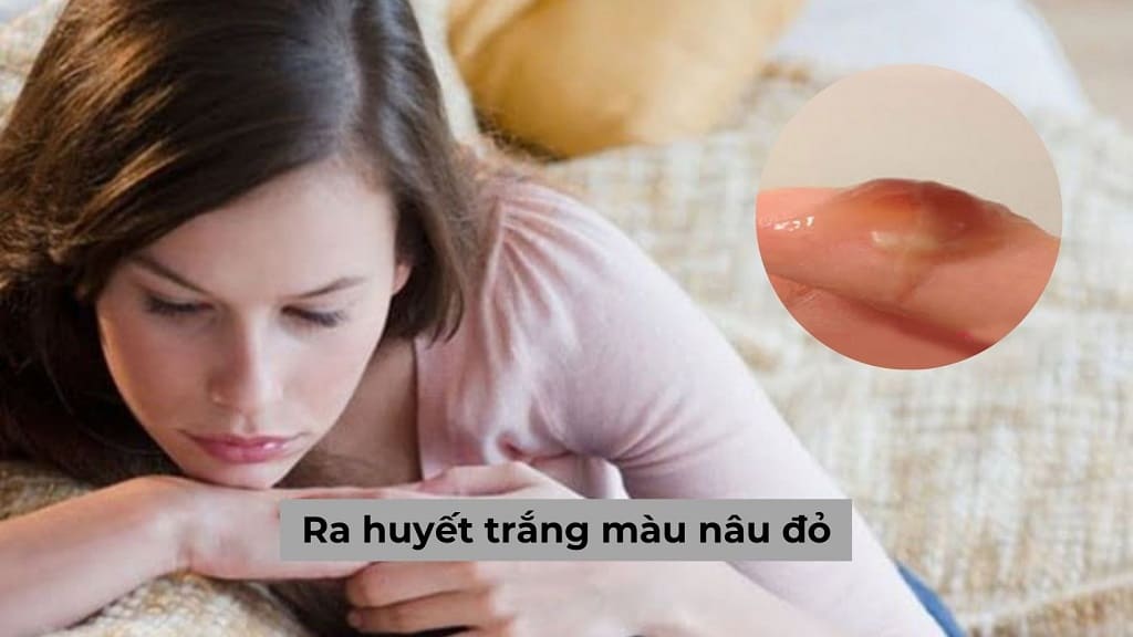 Ra huyết trắng màu nâu đỏ