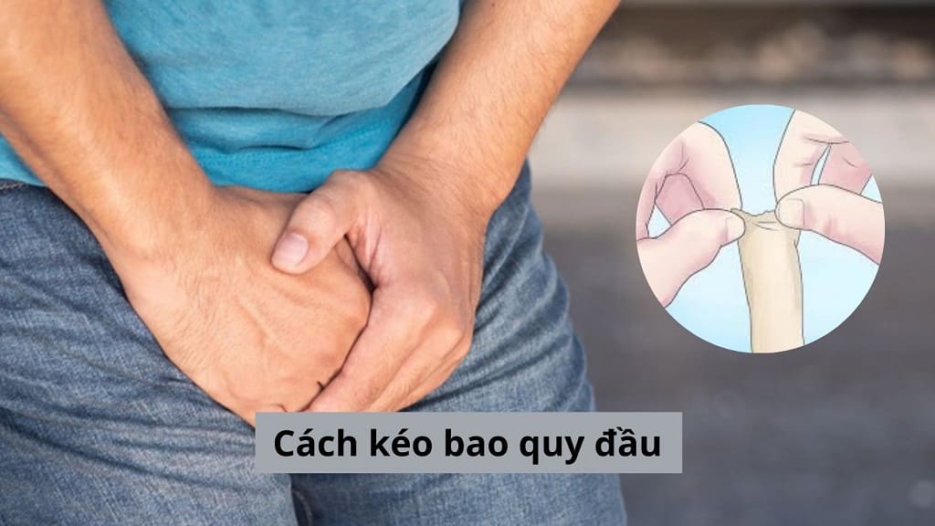 Cách kéo bao quy đầu