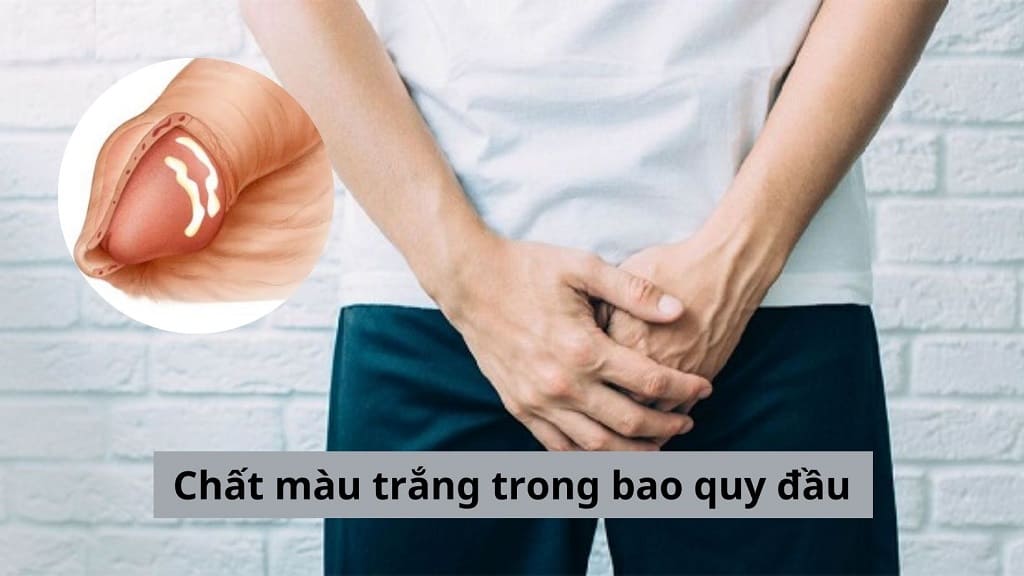 Chất màu trắng trong bao quy đầu