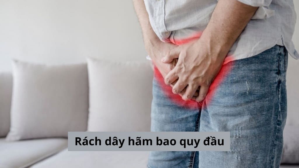 Rách dây hãm bao quy đầu