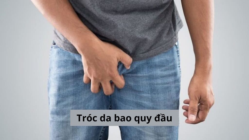 Tróc da bao quy đầu