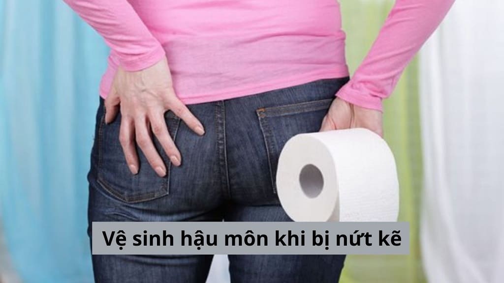 Vệ sinh hậu môn khi bị nứt kẽ