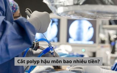 Gỡ rối thắc mắc cắt polyp hậu môn bao nhiêu tiền?