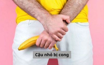 Cậu nhỏ bị cong và các vấn đề nam giới cần biết