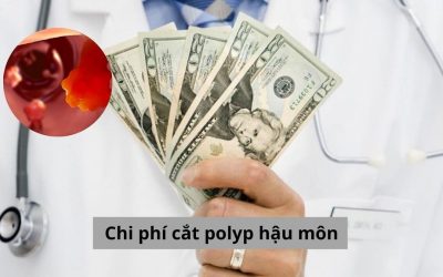 Chi phí cắt polyp hậu môn hết bao nhiêu tiền? Địa chỉ chữa bệnh uy tín