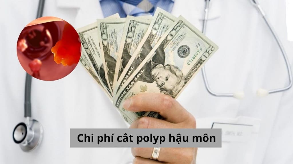 Chi phí cắt polyp hậu môn