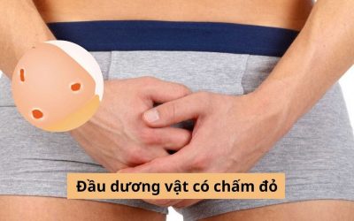 Đầu dương vật có chấm đỏ là bị sao, có nguy hiểm không? 