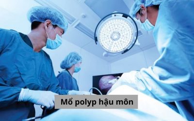 Mổ polyp hậu môn khi nào? Chia sẻ về phương pháp mổ tốt nhất hiện nay