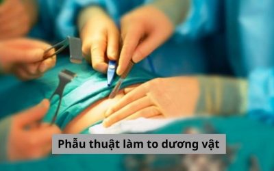 Phẫu thuật làm to dương vật và những điều nam giới nên biết