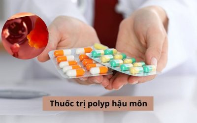 Tổng hợp các loại thuốc trị polyp hậu môn: Ưu nhược điểm, cách sử dụng