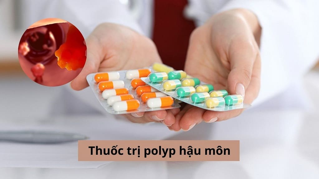 Thuốc trị polyp hậu môn