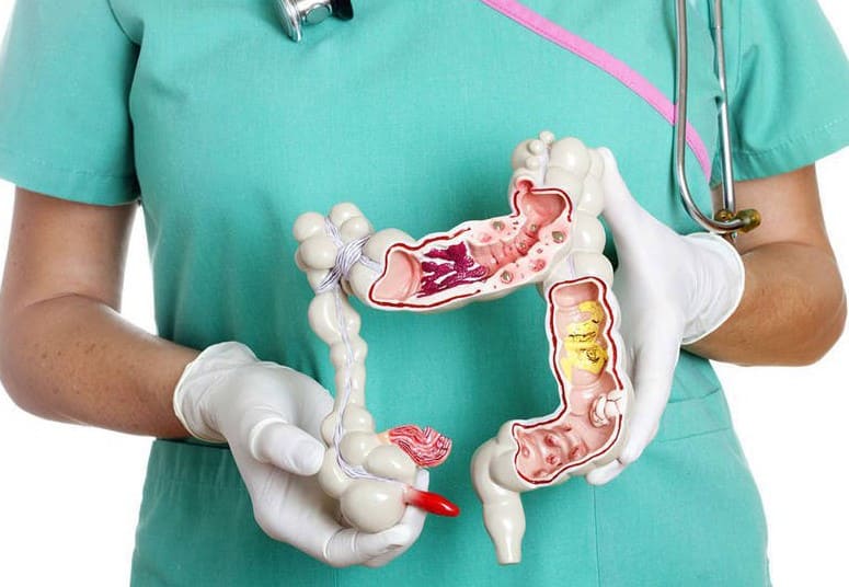 Bệnh polyp hậu môn có nguy hiểm không? 