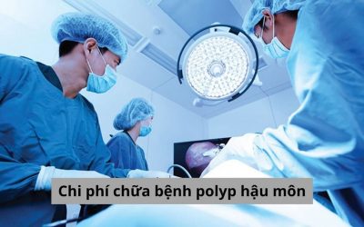 Chi phí chữa bệnh polyp hậu môn bao nhiêu tiền? [Bảng giá chi tiết]