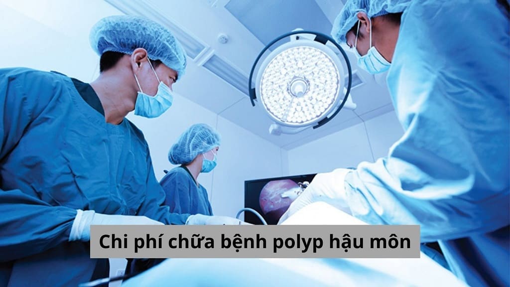 Chi phí chữa bệnh polyp hậu môn