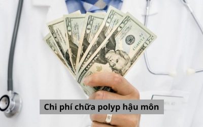 Chi phí chữa polyp hậu môn đắt không? Điều trị ở đâu uy tín? 