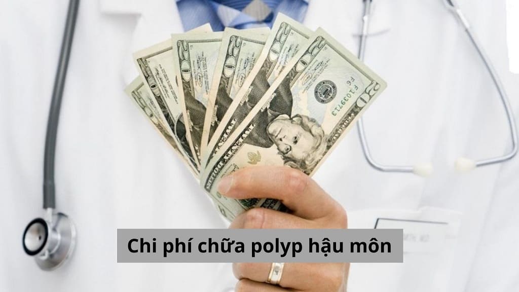 Chi phí chữa polyp hậu môn