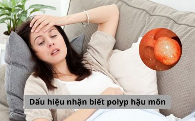 5 Dấu hiệu nhận biết polyp hậu môn và cách điều trị dứt điểm