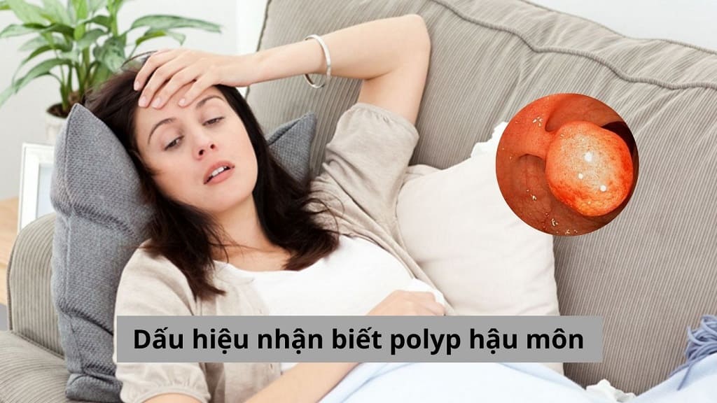 Dấu hiệu nhận biết polyp hậu môn