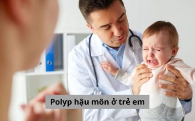 Polyp hậu môn ở trẻ em và những điều bố mẹ cần biết