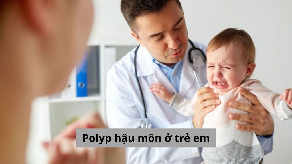 Polyp hậu môn ở trẻ em