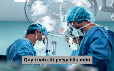 Quy trình cắt polyp hậu môn như thế nào và một số lưu ý