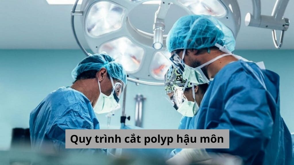 Quy trình cắt polyp hậu môn