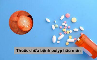 Thuốc chữa bệnh polyp hậu môn liệu có thực sự hiệu quả?