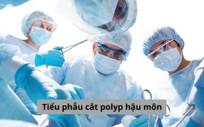 Tổng hợp những vấn đề cần biết về tiểu phẫu cắt polyp hậu môn