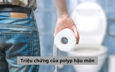 Các triệu chứng của polyp hậu môn thường gặp và cách điều trị 