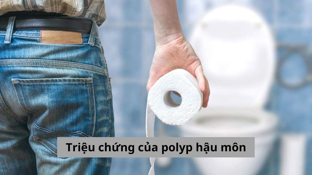 Triệu chứng của polyp hậu môn