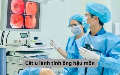 Cắt u lành tính ống hậu môn là gì? Phương pháp cắt u lành tính an toàn