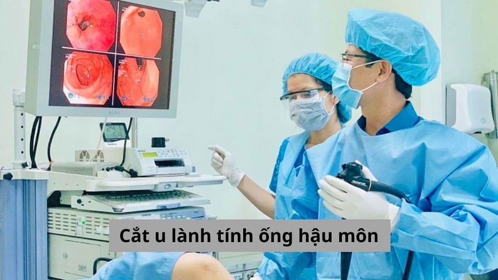 Cắt u lành tính ống hậu môn