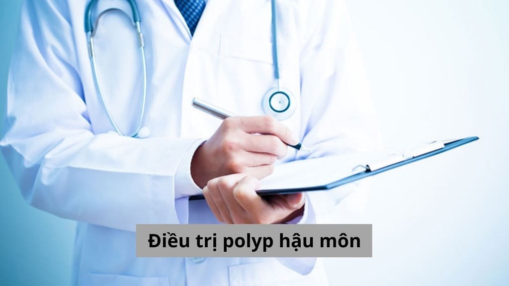 Điều trị polyp hậu môn