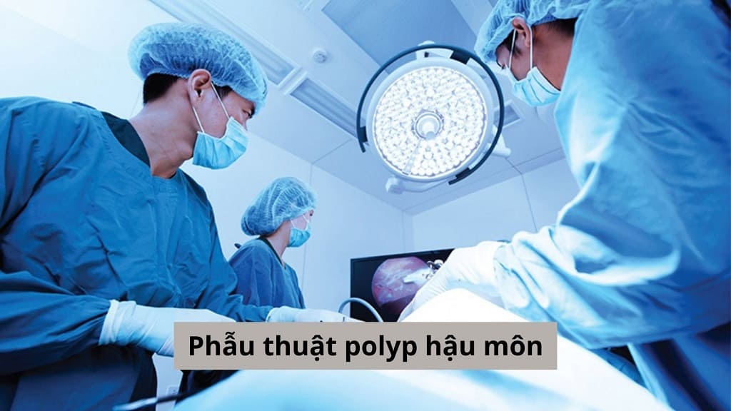 Phẫu thuật polyp hậu môn