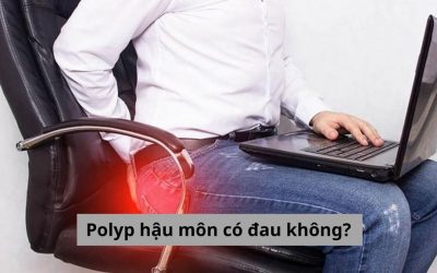 [Chuyên mục giải đáp] Polyp hậu môn có đau không?