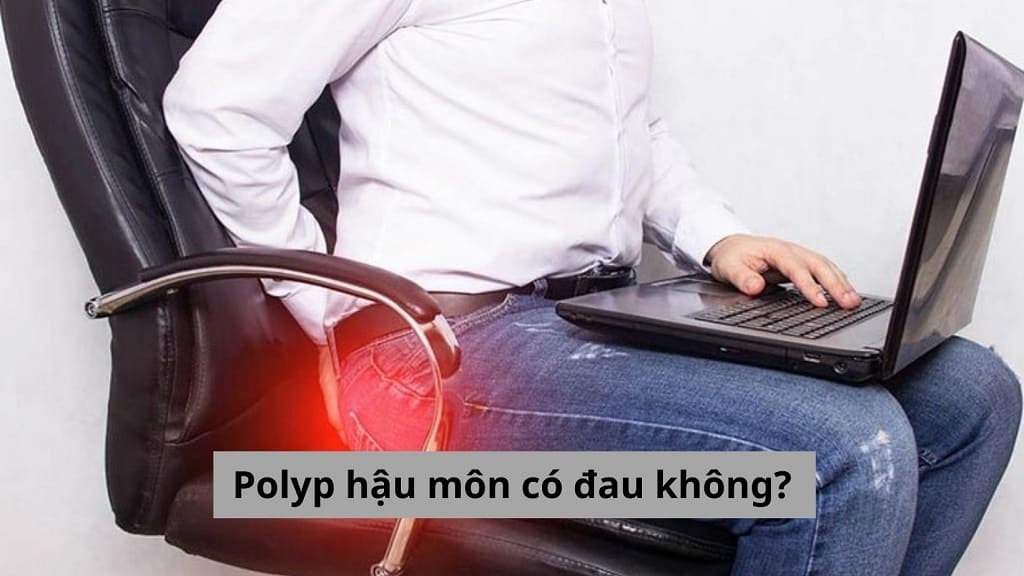 Polyp hậu môn có đau không