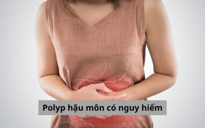 [Gỡ rối băn khoăn] Polyp hậu môn có nguy hiểm không?