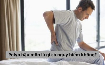 [Góc giải đáp thắc mắc] Polyp hậu môn là gì có nguy hiểm không?