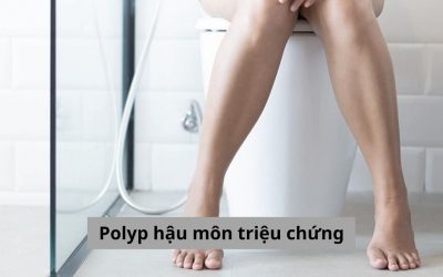 Hỏi đáp Bác sĩ: Người bị polyp hậu môn triệu chứng như thế nào? 