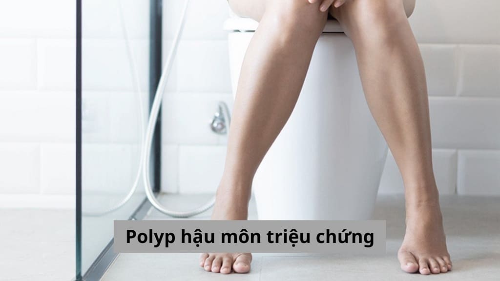 Polyp hậu môn triệu chứng