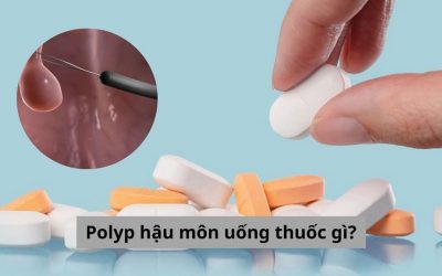 Polyp hậu môn uống thuốc gì? Bác sĩ chuyên khoa giải đáp