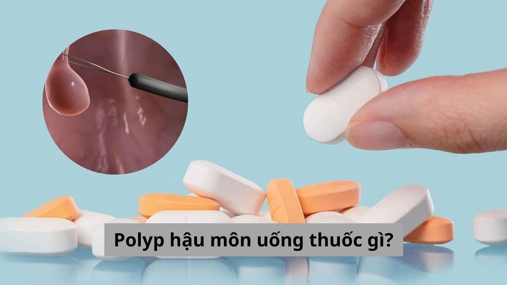 Polyp hậu môn uống thuốc gì